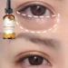 Effective Natural Eye Oil to Reduce Dark Circles and Soothe Puffiness Effective Natural Eye Oil to Reduce Dark Circles and Soothe Puffiness